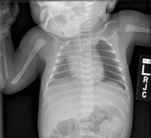 X-ray showing some of the delicate inner structures of the body of an infant.